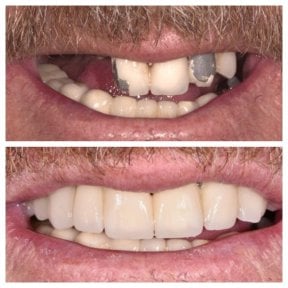 Nifa Dent International