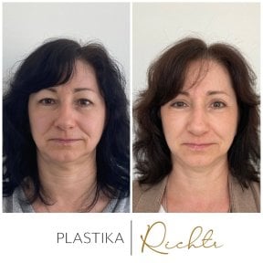 Czech Hospital of Horovice