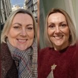 Fotos de antes e depois de Cirurgia de manga gástrica (Gastrectomia em manga) pelo Dr. 