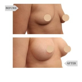 Clínica de cirurgia plástica InSense (SV Plastic Surgery Clinic)