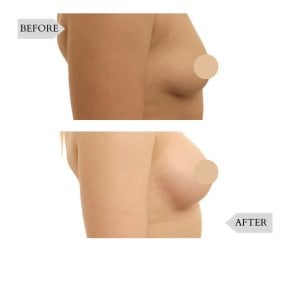 Clínica de cirurgia plástica InSense (SV Plastic Surgery Clinic)