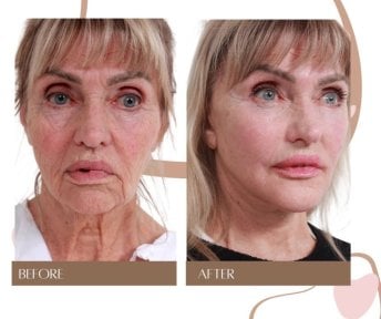 InSense Clinic (SV Plastic Surgery Clinic) 