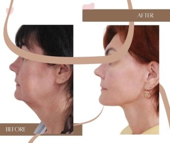 InSense Clinic (SV Plastic Surgery Clinic) 