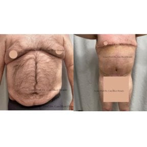 Memorial Şişli Hospital