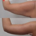 Photos avant et après par le Dr 