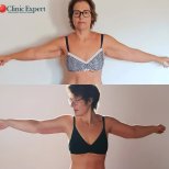 Photos avant et après par le Dr 