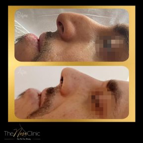 Клиника эстетики носа (The Nose Aesthetic Clinic)