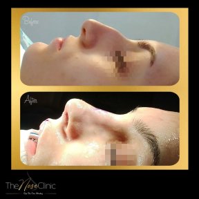 Клиника эстетики носа (The Nose Aesthetic Clinic)