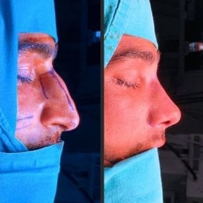 Istanbul Aesthetic Plastic Surgery Center