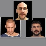 Before and after FUE hair transplant results at Dr. Ilker Manavbasi's Clinic, restored hairline