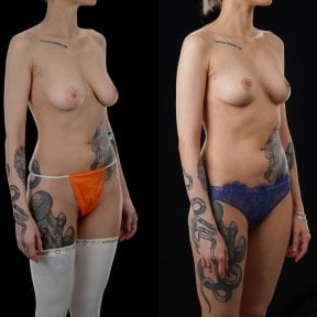 Yurchenko Plastic Surgery Team