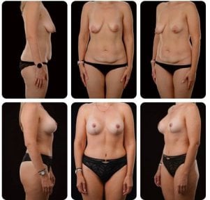 Yurchenko Plastic Surgery Team