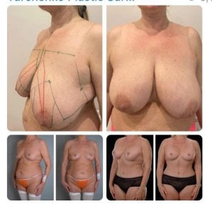 Yurchenko Plastic Surgery Team