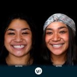 Fotos de antes y después de Implante dental tomadas por el Dr.(la Dra.) 