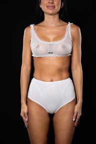 Résultat de la mammoplastie à la Vidnova Clinic – forme et galbe des seins améliorés