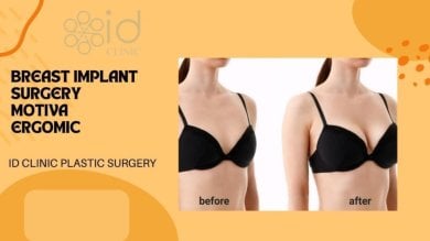 Before and after breast augmentation results at ID Clinic Bangkok with Motiva Ergonomic implants
