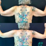 Photos avant et après par le Dr 