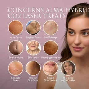 Проблеми, які вирішує CO2-лазер у Alpha Beauty Hannover: рубці, зморшки, пігментація, пори