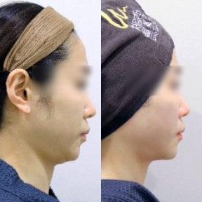 Клиника эстетической медицины Lalian Cheongdam