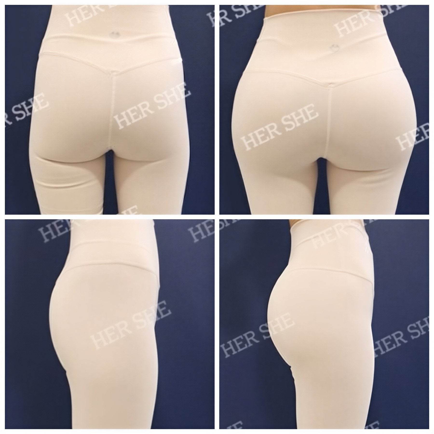 نتائج قبل وبعد عملية Brazilian Butt Lift في HERSHE Plastic Surgery Korea، منحنيات محسنة