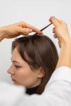 PRP-Haarverlustbehandlung in der Altos Clinic – Haaruntersuchung vor dem Eingriff
