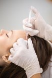 PRP-Haarausfallbehandlung bei Altos Clinic zur Haarwiederherstellung