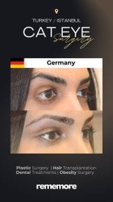 before-after photo upper-eyelid-surgery