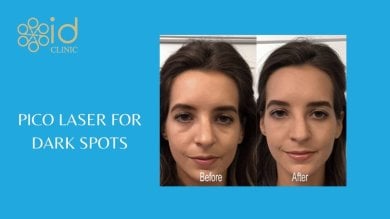 before-after photo skin-rejuvenation