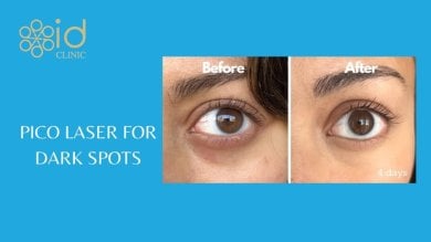before-after photo skin-rejuvenation