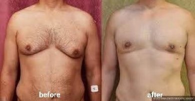 before-after photo penis-enlargement