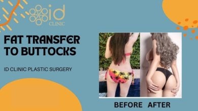 before-after photo brazilian-butt-lift