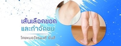 Laser hair removal and varicose vein treatment results at Yanhee International Hospital