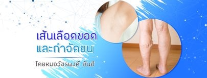 Laser hair removal and varicose vein treatment results at Yanhee International Hospital
