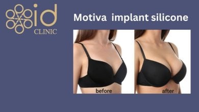 Результаты до и после коррекции груди с имплантами Motiva в ID Clinic Bangkok