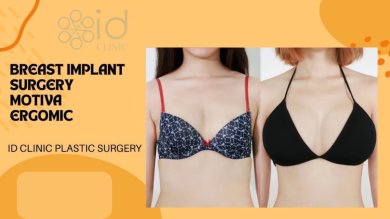 before-after photo breast-augmentation