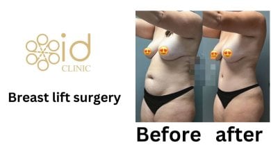 before-after photo mastopexy-breast-lift-contour-plastics