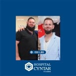Before and after gastric sleeve surgery at HOSPITAL CYNTAR TIJUANA, 150 lbs weight loss result