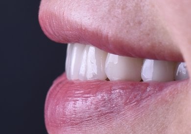 before-after photo dental-implant