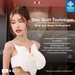 MTF gender affirmation surgery result at Yanhee International Hospital with skin graft technique
