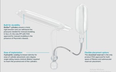 Penile implant device for penis enlargement at Yanhee International Hospital, surgical result