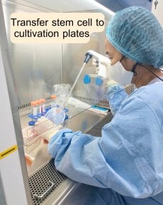 PRP therapy preparation at ID Clinic Bangkok – stem cell transfer to cultivation plates