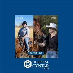 نتائج تكميم المعدة قبل وبعد في HOSPITAL CYNTAR TIJUANA، فقدان 61 كجم