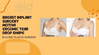 Before and after breast augmentation with Motiva implants at ID Clinic Bangkok, visible results
