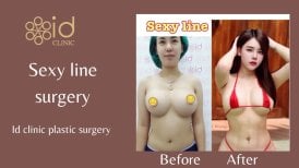 Before and after sexy line surgery results at ID Clinic Bangkok, enhanced body contour