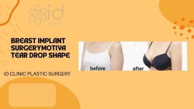 Before and after breast augmentation with Motiva teardrop implants at ID Clinic Bangkok