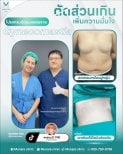 Результати до і після операції гінекомастії в Munare Clinic Chiangmai, плоскі груди