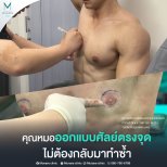 Результати до і після операції гінекомастії в Munare Clinic Chiangmai, покращений контур грудей