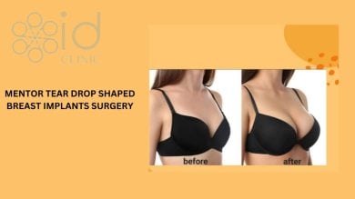 before-after photo uvelicenie-grudi