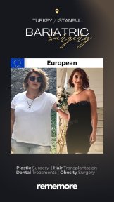 before-after photo roux-en-y-gastric-bypass