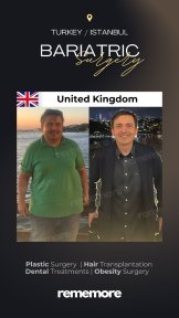 before-after photo roux-en-y-gastric-bypass
